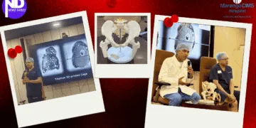 Marengo CIMS Hospital's 3D-Printed Hip Reconstruction