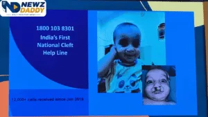 Muskaan Campaign Takes Free Cleft Care
